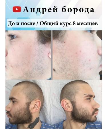 Hair and beard growth - Buy Online on GoSupps.com