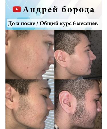 Hair and beard growth - Buy Online on GoSupps.com