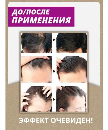 911 Your emergency service 911 burdock against hair loss 2 pcs - Buy Online on GoSupps.com