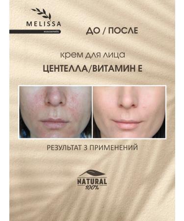 MELISSAecocosmetic Facial cream Nutrum Centella and Vitamin E - Buy Online on GoSupps.com