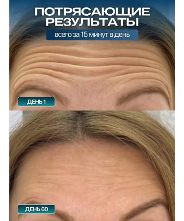 TELZEN Microticle massage device for the face and body electric - Buy Online on GoSupps.com