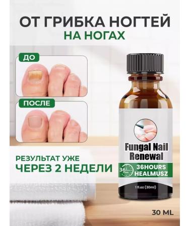 SALE Chinese remedy for nail fungus 30 ml - Buy Online on GoSupps.com