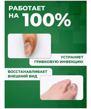 SALE Chinese remedy for nail fungus 30 ml - Buy Online on GoSupps.com