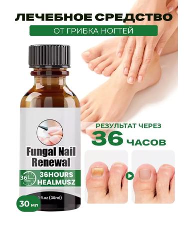 SALE Chinese remedy for nail fungus 30 ml - Buy Online on GoSupps.com
