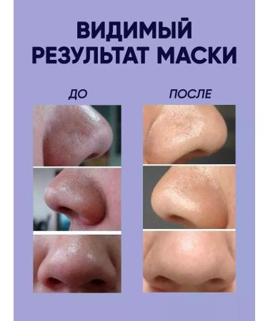 Face mask from black dots - Buy Online on GoSupps.com