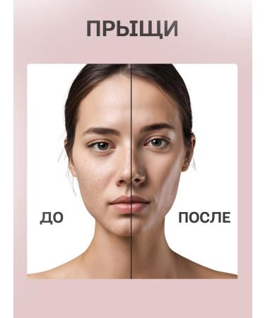 108 herbs Pencil from corns celandine from papillomas and acne warts - Buy Online on GoSupps.com