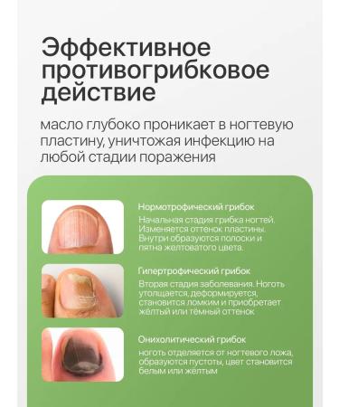 Mua-Mua Remedy for nail fungus and onicholysis - Buy Online on GoSupps.com