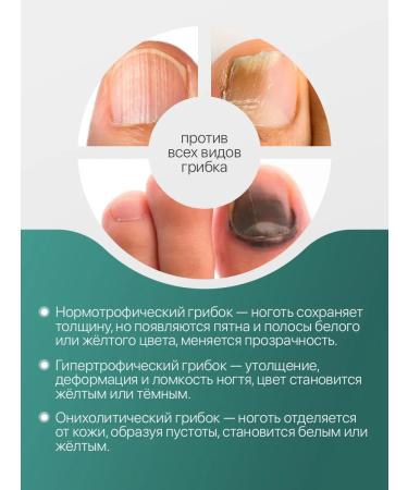 Knapweed Antifungal oil for nails 2 pcs - Buy Online on GoSupps.com