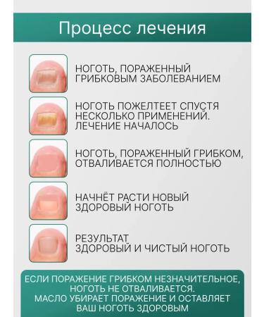 Knapweed Antifungal oil for nails 2 pcs - Buy Online on GoSupps.com