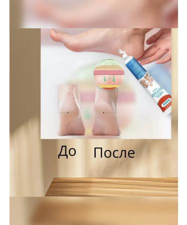 WIVVI Feet cream against cracks - Buy Online on GoSupps.com