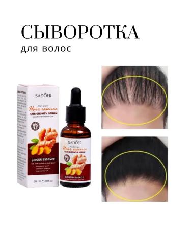 Warehouse No 1 Sadoer hair growth for hair growth