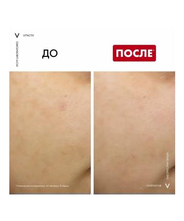Vichy Liftactiv B3 Night Cream and Specialist Serum B3 serum - Buy Online on GoSupps.com