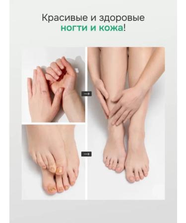 SATRIA Cream from psoriasis fungus and itching - Buy Online on GoSupps.com