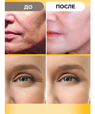 Healthy Products Factory Facial cream anti -aging - Buy Online on GoSupps.com