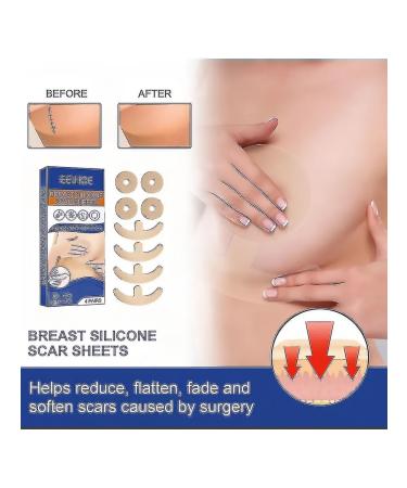 Breastscarremovalstickerprofessionalflatteningscarsheetscarr - Buy Online on GoSupps.com