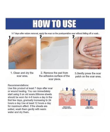 Breastscarremovalstickerprofessionalflatteningscarsheetscarr - Buy Online on GoSupps.com