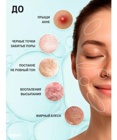 YASOMA Acne and post-acne facial serum with salicylic acid - Buy Online on GoSupps.com