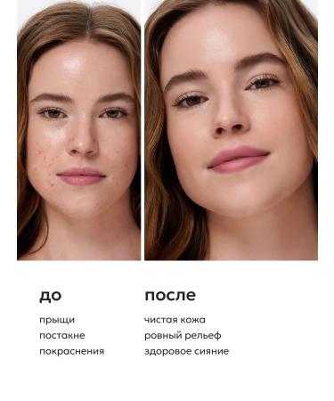 Likato professional Contractor from the face and body acne 110 ml - Buy Online on GoSupps.com