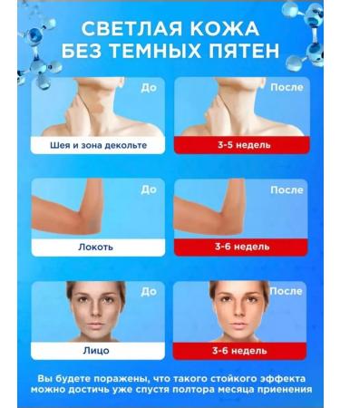 Orva Cream against age spots and freckles Expigment 4% - Buy Online on GoSupps.com