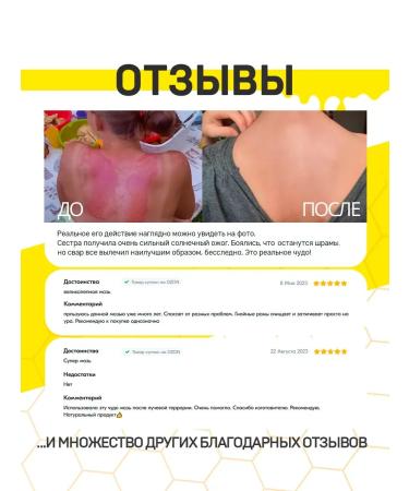 Green box Balm Russian War from wounds and burns 2 pcs - Buy Online on GoSupps.com