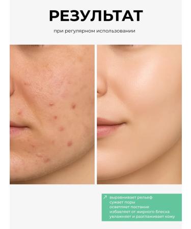 SPARCLI Bubble face mask - Buy Online on GoSupps.com