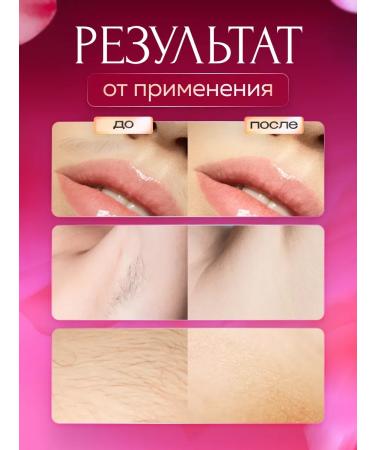 LKK Laser photoeplator is unlimited - Buy Online on GoSupps.com