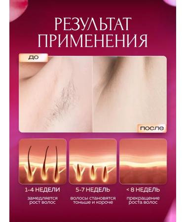 LKK Laser photoeplator is unlimited - Buy Online on GoSupps.com