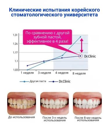 Perioe Toothpaste whitening from plaque and stone - Buy Online on GoSupps.com