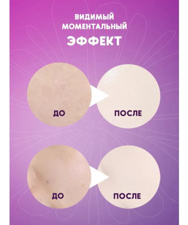 SEOMOU Masks and patches Nabjor in a cosmetic bag 24+3 - Buy Online on GoSupps.com