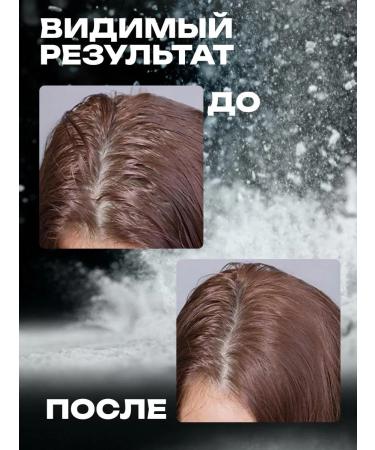 Totti Beauty Hair powder - Buy Online on GoSupps.com