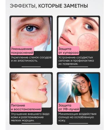 Vitex 3 pcs. Cream for ruling rod on the face - Buy Online on GoSupps.com