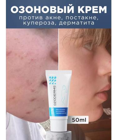OzoneBox Ozodermis 5% cream from acne post -acne and rosacea - Buy Online on GoSupps.com