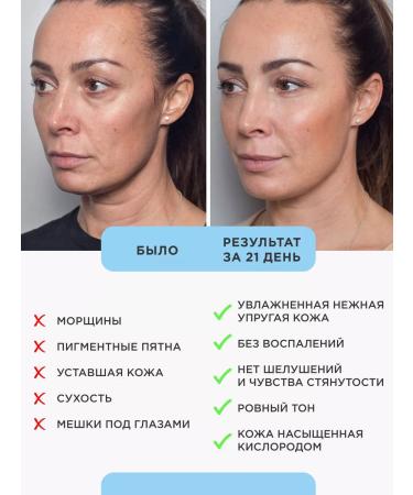 OzoneBox Facial Face Cream Ozone Cream - Buy Online on GoSupps.com