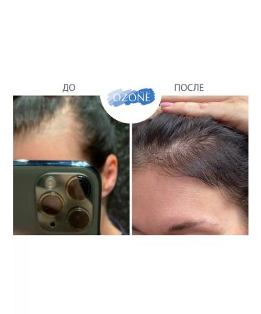OzoneBox 10% ozodermis hair and scalp mask - Buy Online on GoSupps.com