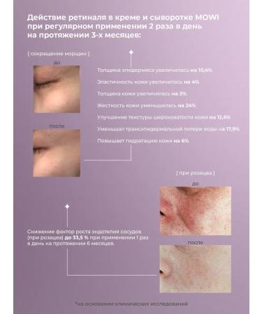 BYMOWI Set of Belarusian serum and face cream with retinol - Buy Online on GoSupps.com