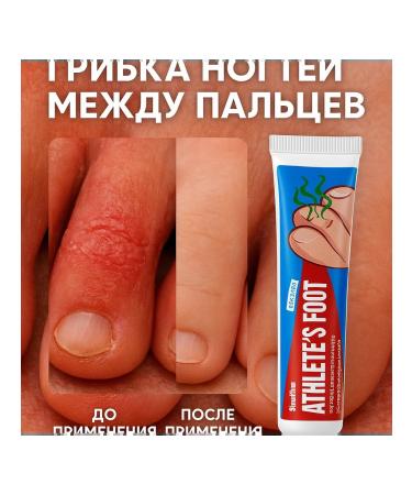 datka7 Antifungal therapeutic foot cream from itching on the legs - Buy Online on GoSupps.com