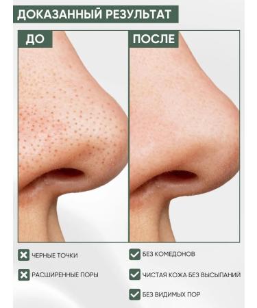 Anua Clay mask for Korea acne - Buy Online on GoSupps.com