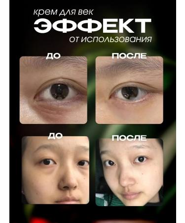 AsiaEssense Set of eyelids and skin around the eyes with astragalus 2pcs - Buy Online on GoSupps.com