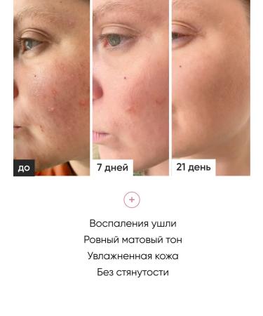 COSMEYA Comprehensive facial care set - Buy Online on GoSupps.com