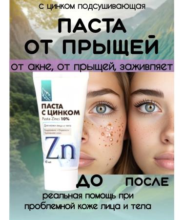 GuSHIYuta Cream of paste from acne and acne and herpes with zinc
