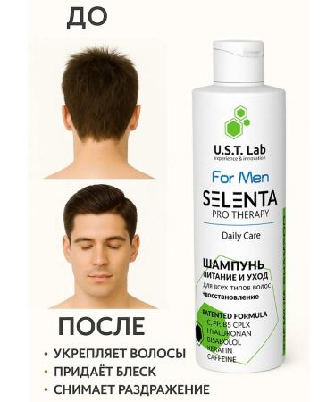 Selenta Shampoo restoring for men - Buy Online on GoSupps.com