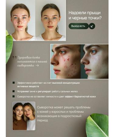 AGEDOWN Facial serum from acne with niacinamide and zinc - Buy Online on GoSupps.com