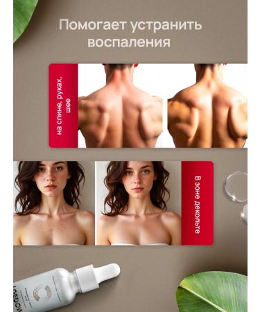 AGEDOWN Facial serum from acne with niacinamide and zinc - Buy Online on GoSupps.com