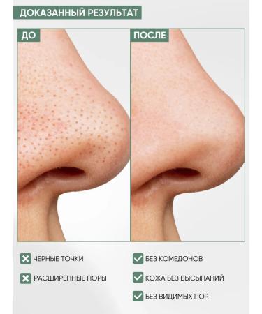 Anua Toner Pads for the face moisturizing exfoliating - Buy Online on GoSupps.com