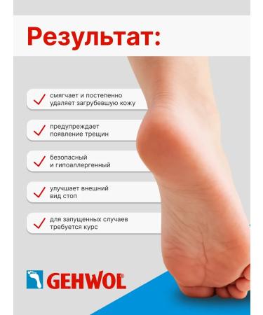 Gehwol Med Hornhaut Cream for ripe skin 125ml - Buy Online on GoSupps.com