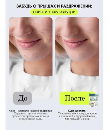 Bionormula Zeolitic remedy for acne and acne - Buy Online on GoSupps.com