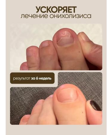 TUZ Cream wax from cracks for very dry skin of the legs and hands 100 ml - Buy Online on GoSupps.com