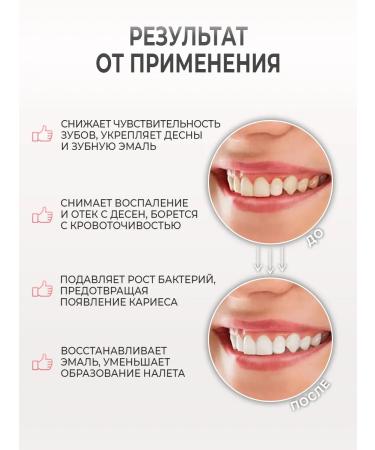 Trimay Toothpaste for sensitive gums Korea - Buy Online on GoSupps.com