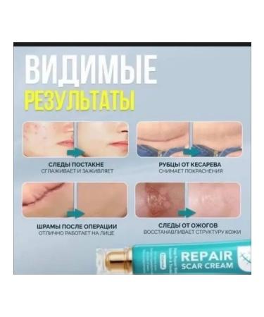 GChe Cream gel from scars of scars post -acne ointment from burns - Buy Online on GoSupps.com
