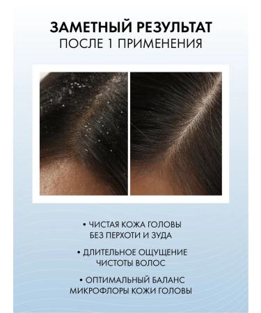 BeautyCevtika Complex Gel Pilling from the fatty head + shampoo from dandruff - Buy Online on GoSupps.com